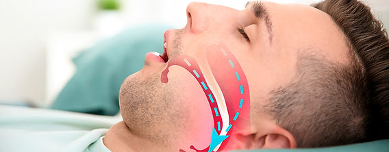 Como tratar a apneia do sono