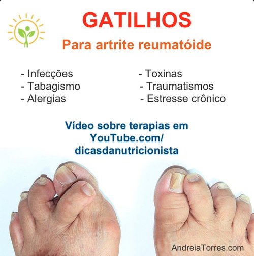 5 Melhores Exercícios para Artrite Reumatoide nas Mãos