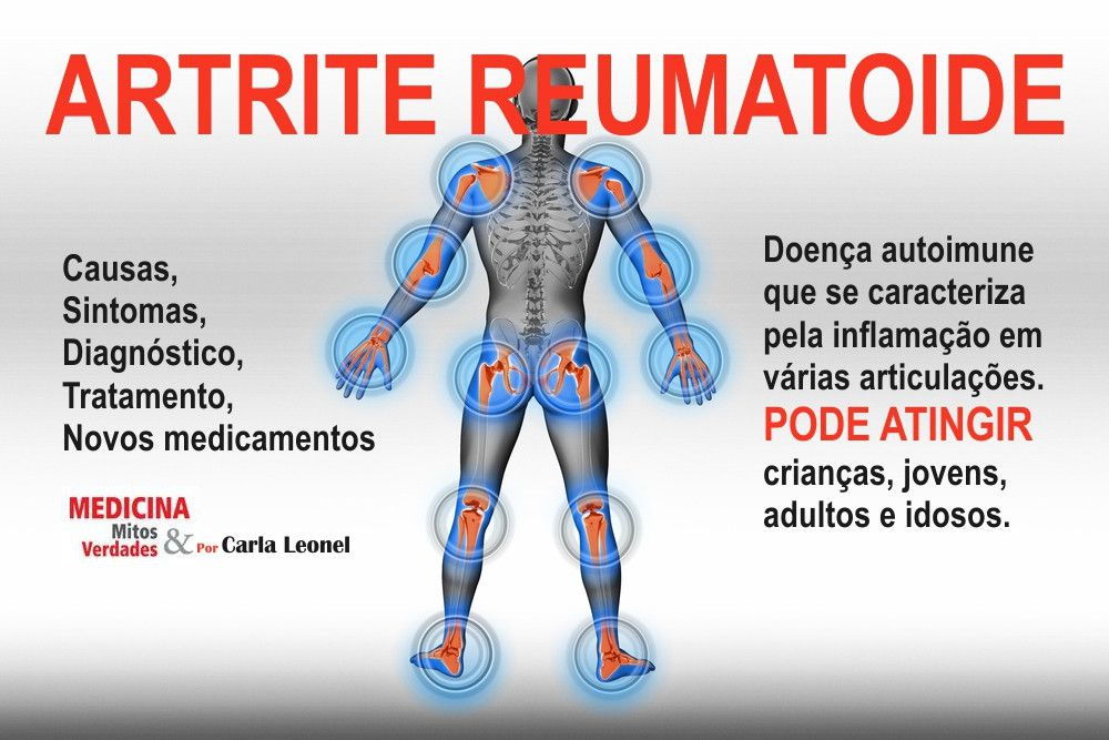 Fisioterapia e Terapia Ocupacional: Aliadas Essenciais no Tratamento da AR
