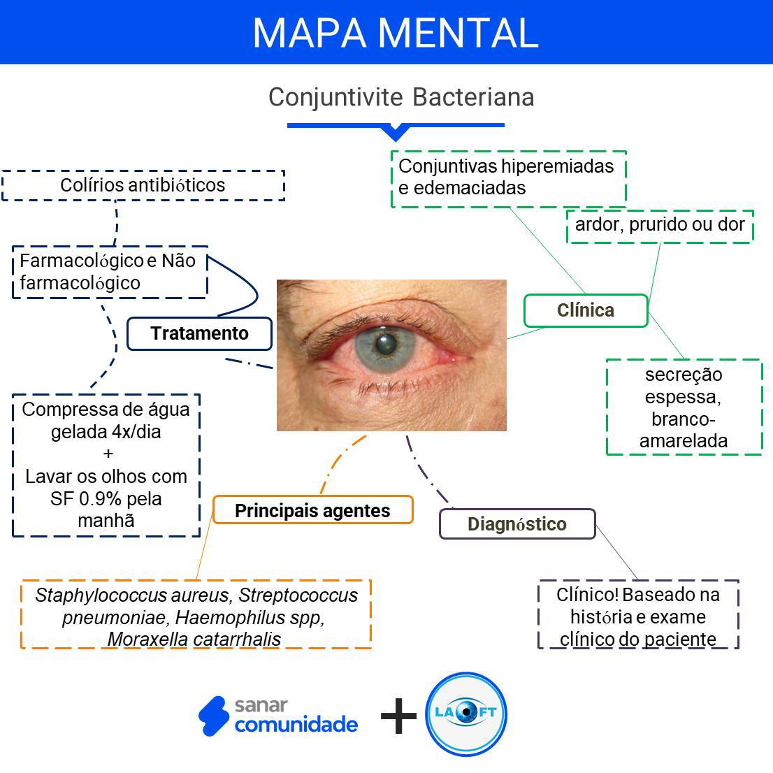 Como tratar a conjuntivite