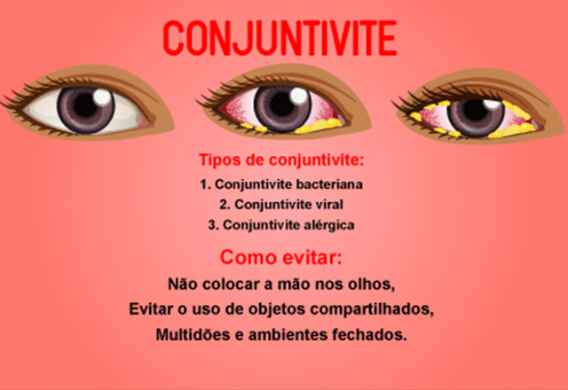 Guia Completo de Higiene Ocular para Prevenir Conjuntivite