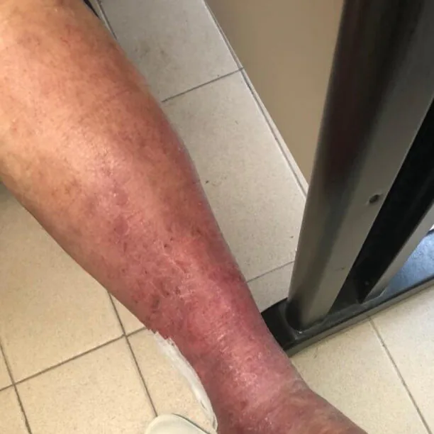 Guia completo de meias de compressão