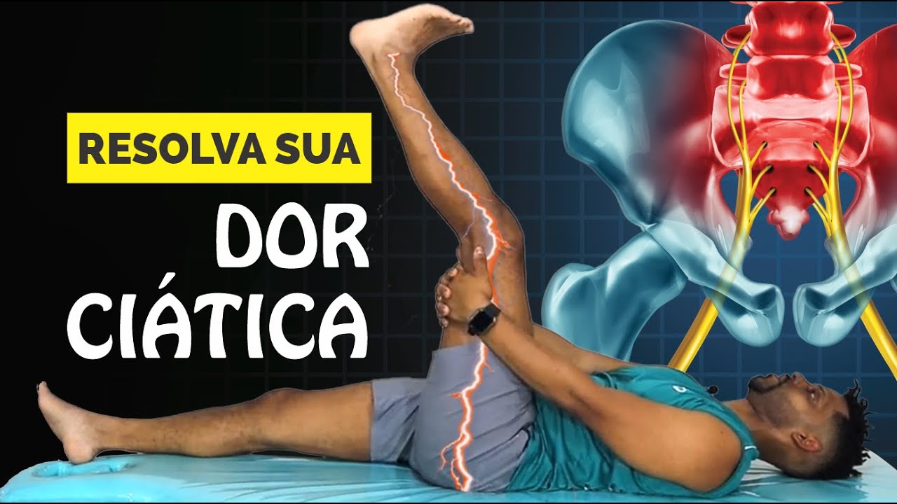 Como tratar a dor ciática
