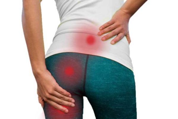 Como tratar a dor ciática