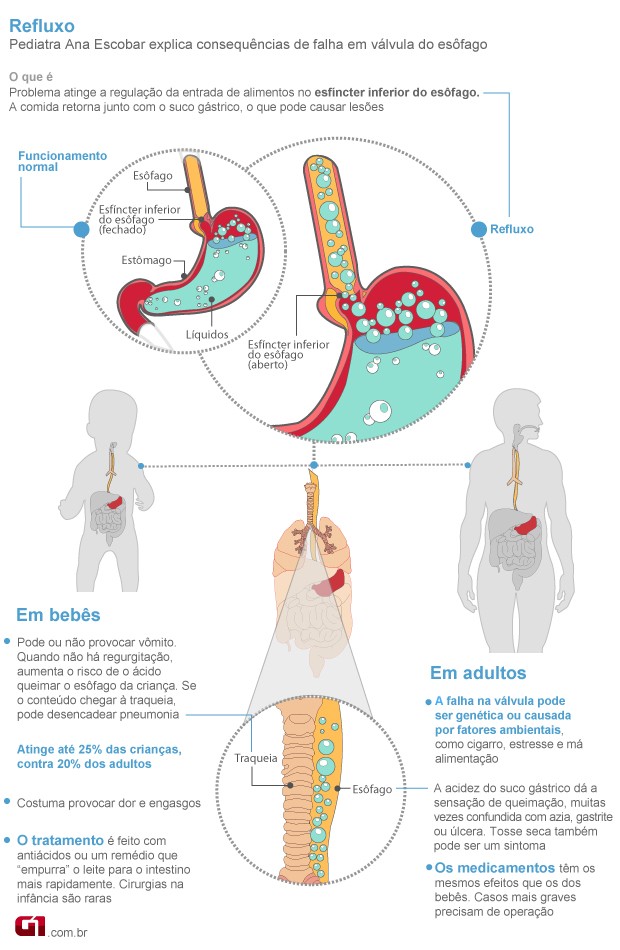 10 Remédios Naturais para Aliviar a Dor de Estômago Rapidamente