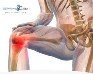 Guia Completo de Suplementos para Saúde Articular