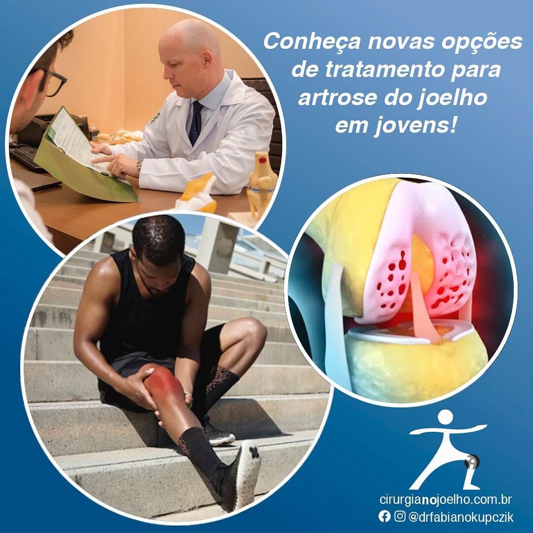 Infiltrações e Terapias Biológicas: Novas Esperanças para a Artrose