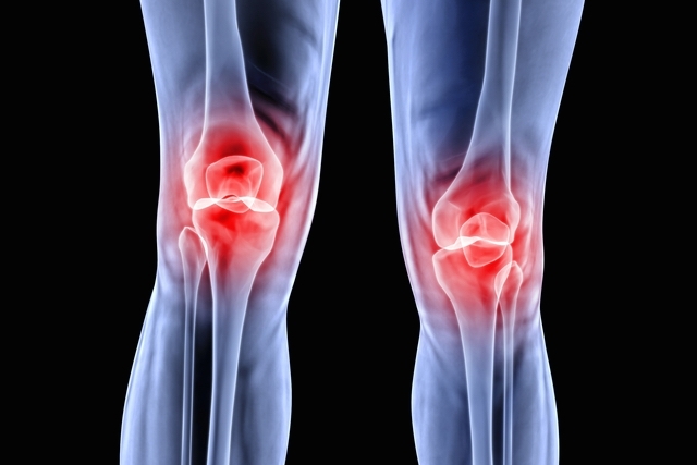 Quando a Fisioterapia Não é Suficiente: Opções Cirúrgicas para Condropatia