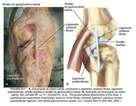 Quando a Cirurgia é a Melhor Opção para o LCL?