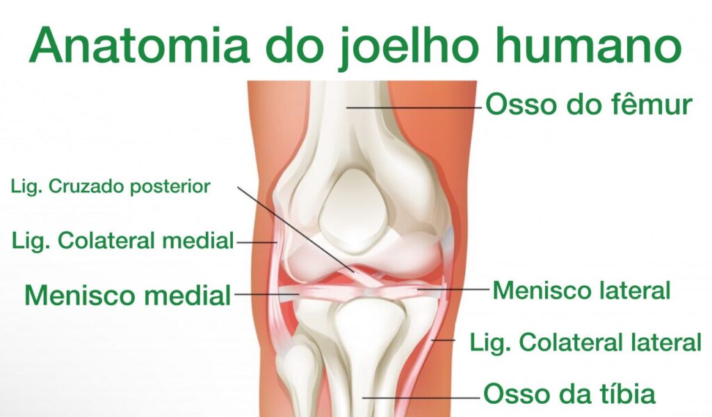 Como tratar a dor no joelho por lesão no ligamento colateral lateral