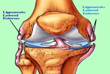 Graus de Lesão do LCL: Entenda as Diferenças