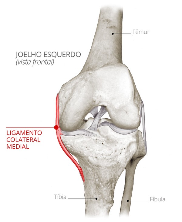 Prevenção de Novas Lesões no Joelho Após o Tratamento do LCM