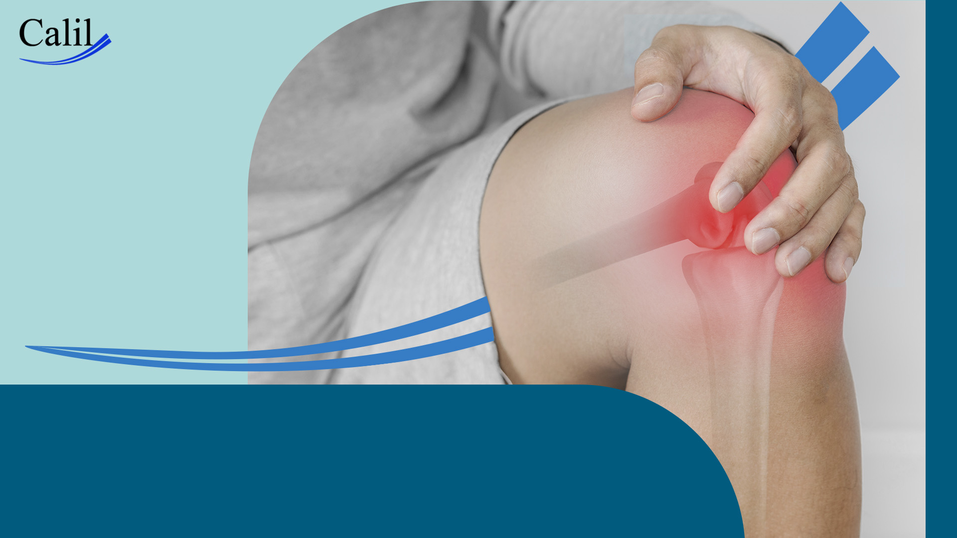 Entenda o Protocolo RICE para Lesões no Joelho