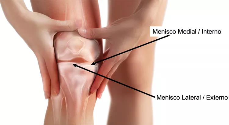 5 Exercícios Essenciais para Recuperação do Menisco