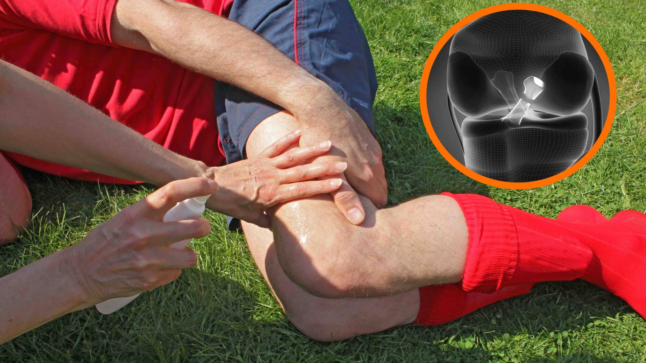 Como tratar a dor no joelho por ligamento rompido