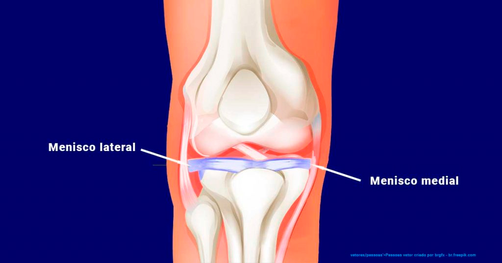 5 Exercícios de Fisioterapia para Menisco Rompido