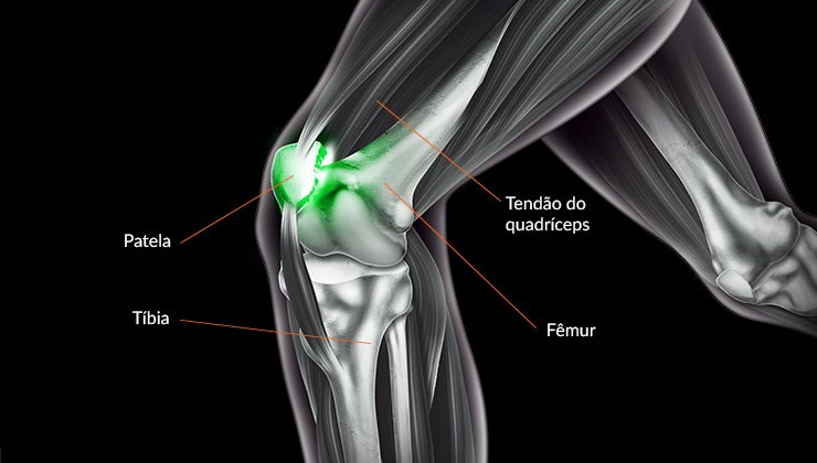 Como Usar Gelo Corretamente para Lesões no Joelho