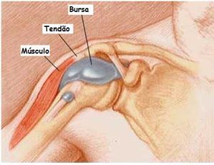 Entenda os Estágios da Ruptura do Manguito Rotador