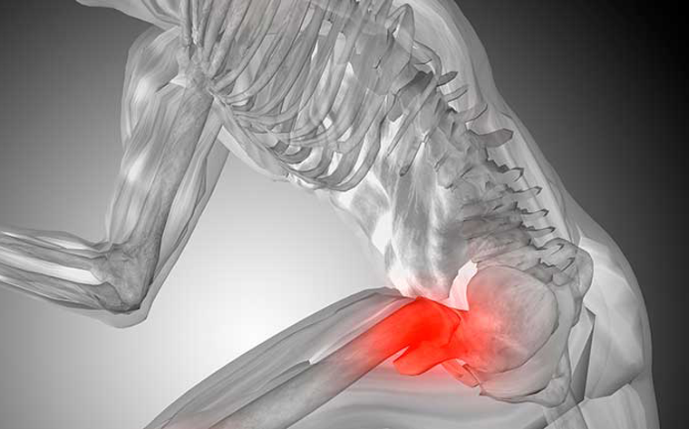 5 Exercícios para Aliviar a Dor no Quadril em Casa