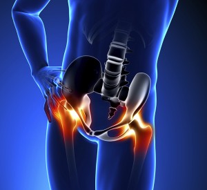 Quando a Dor no Quadril Indica um Problema Mais Sério?