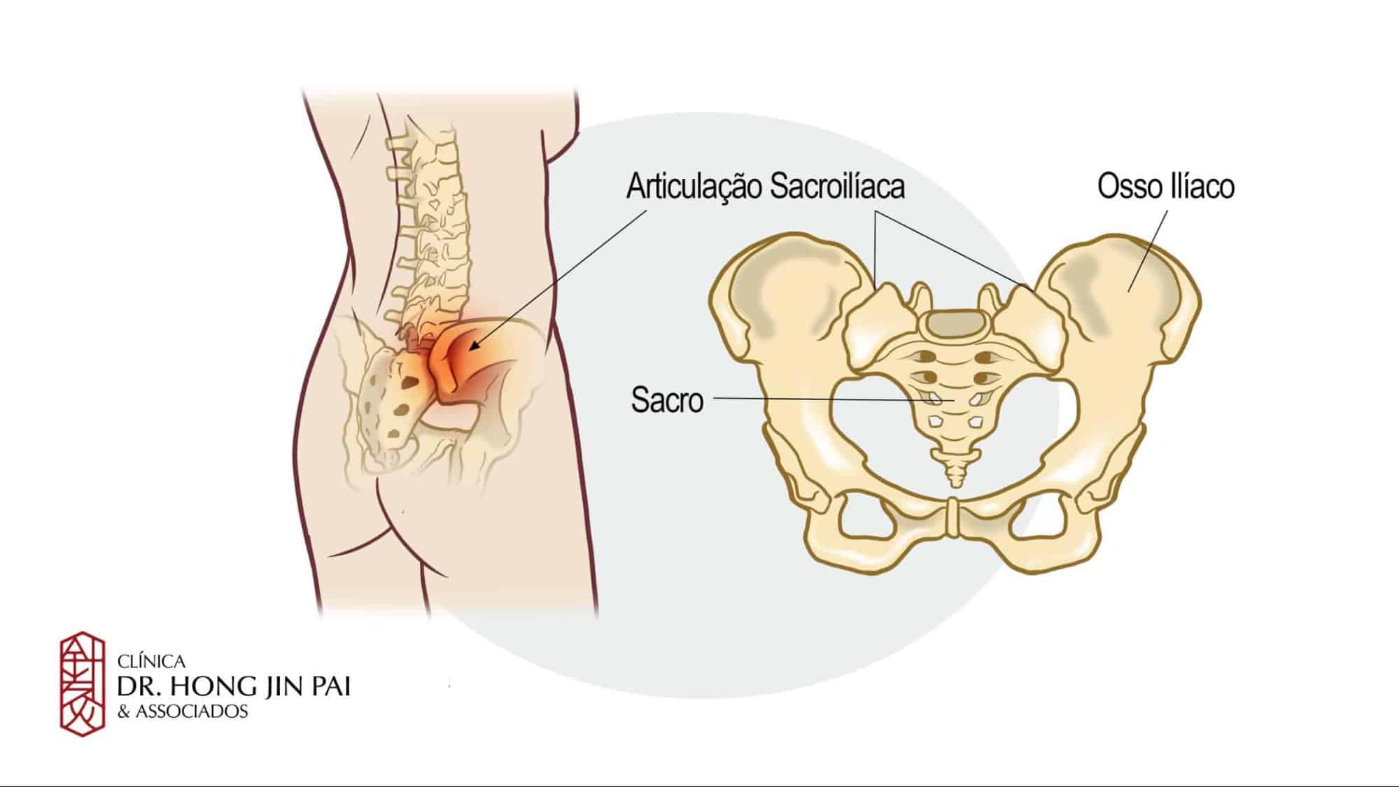 Fisioterapia Pélvica na Gestação: Um Guia Completo