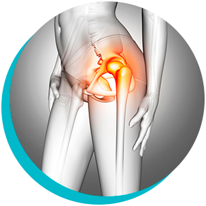 Suplementos Naturais para a Saúde da Cartilagem do Quadril