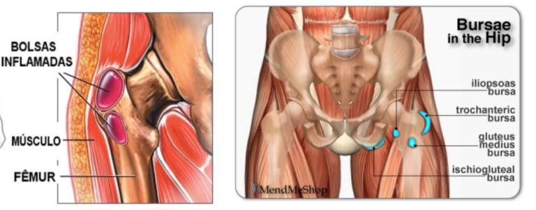 5 Exercícios de Alongamento para Bursite no Quadril