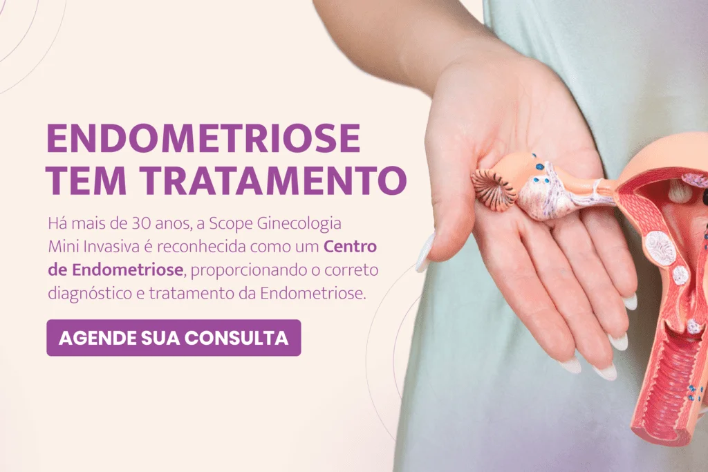 10 Alimentos Anti-inflamatórios para Combater a Endometriose