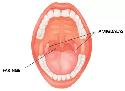 Como tratar a faringite