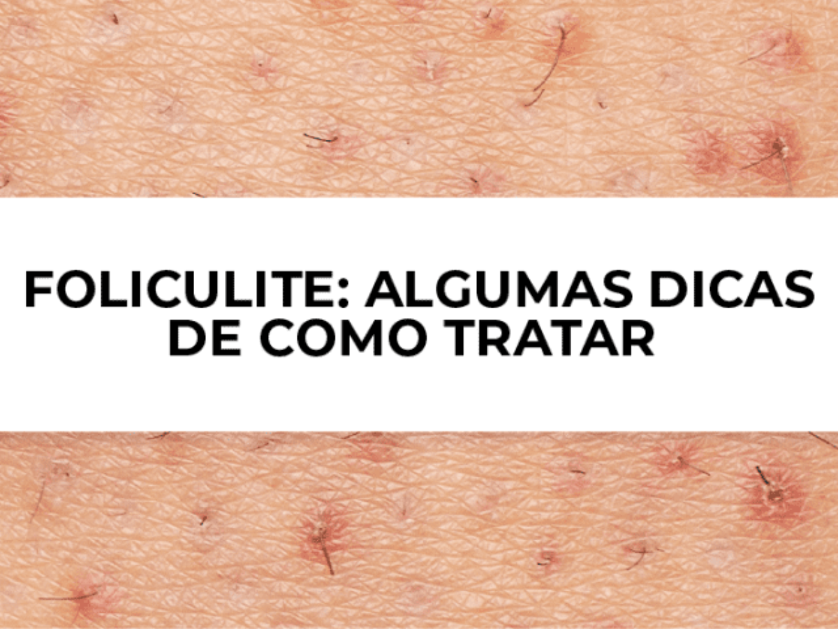 Como tratar a foliculite