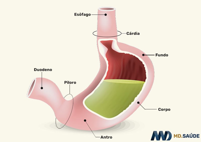 Como tratar a gastrite crônica atrófica