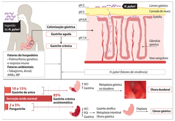 Guia Completo da Dieta para Gastrite Atrófica