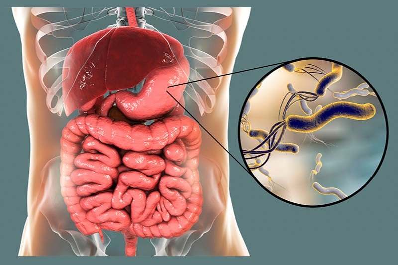 Guia completo da dieta para gastrite