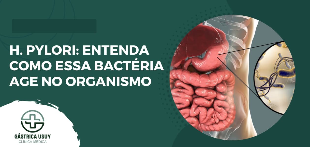 Como tratar a gastrite por Helicobacter pylori