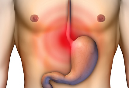 Diferenças entre Gastrite Biliar e Medicamentosa