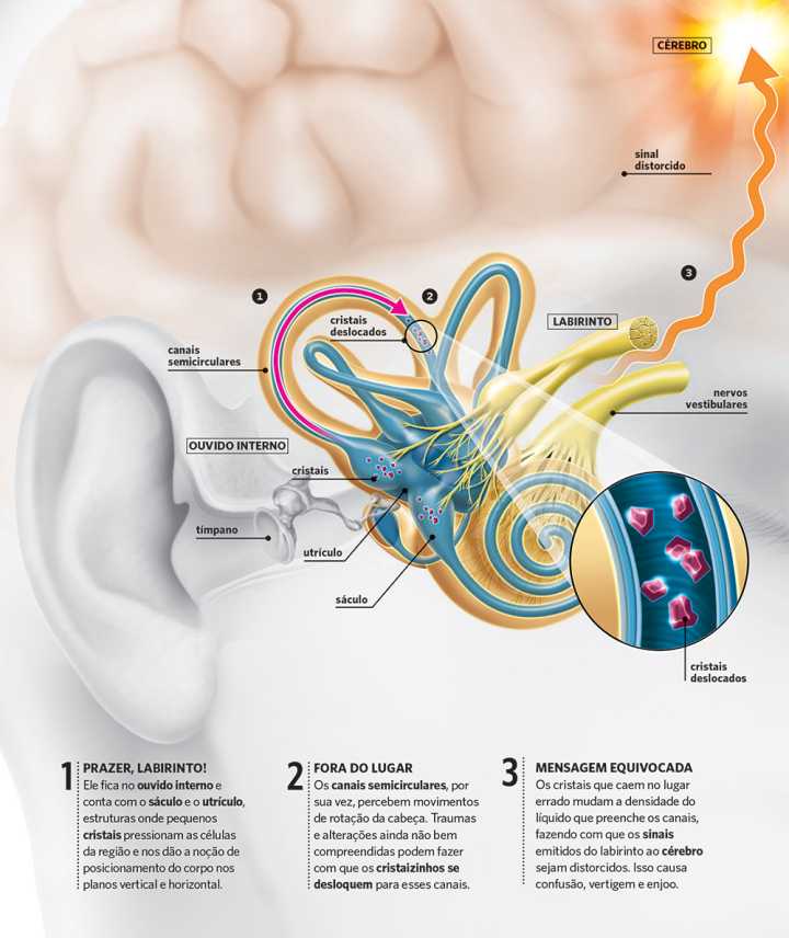 Reabilitação vestibular: o que é e como funciona