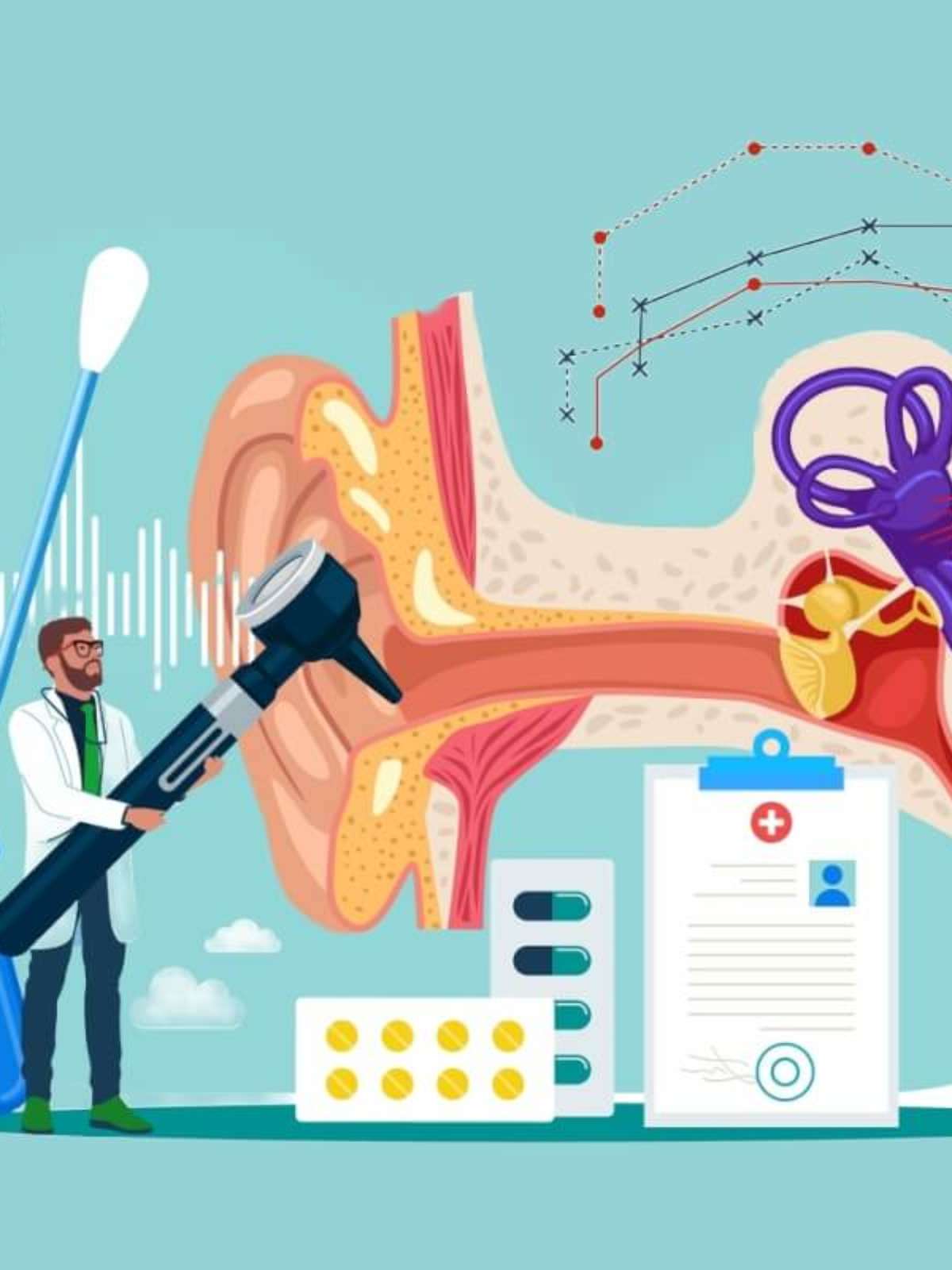 Entendendo a Neurite Vestibular: Diferenças da Labirintite