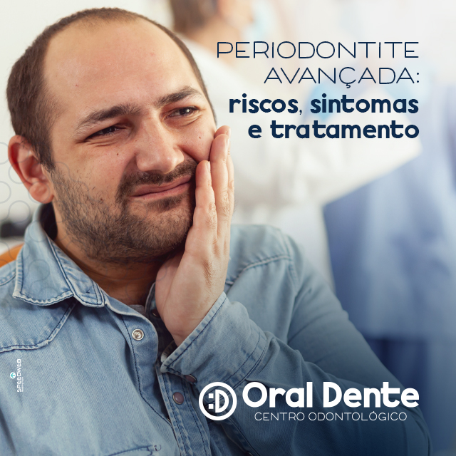 Sintomas da Periodontite Avançada: Um Guia Completo