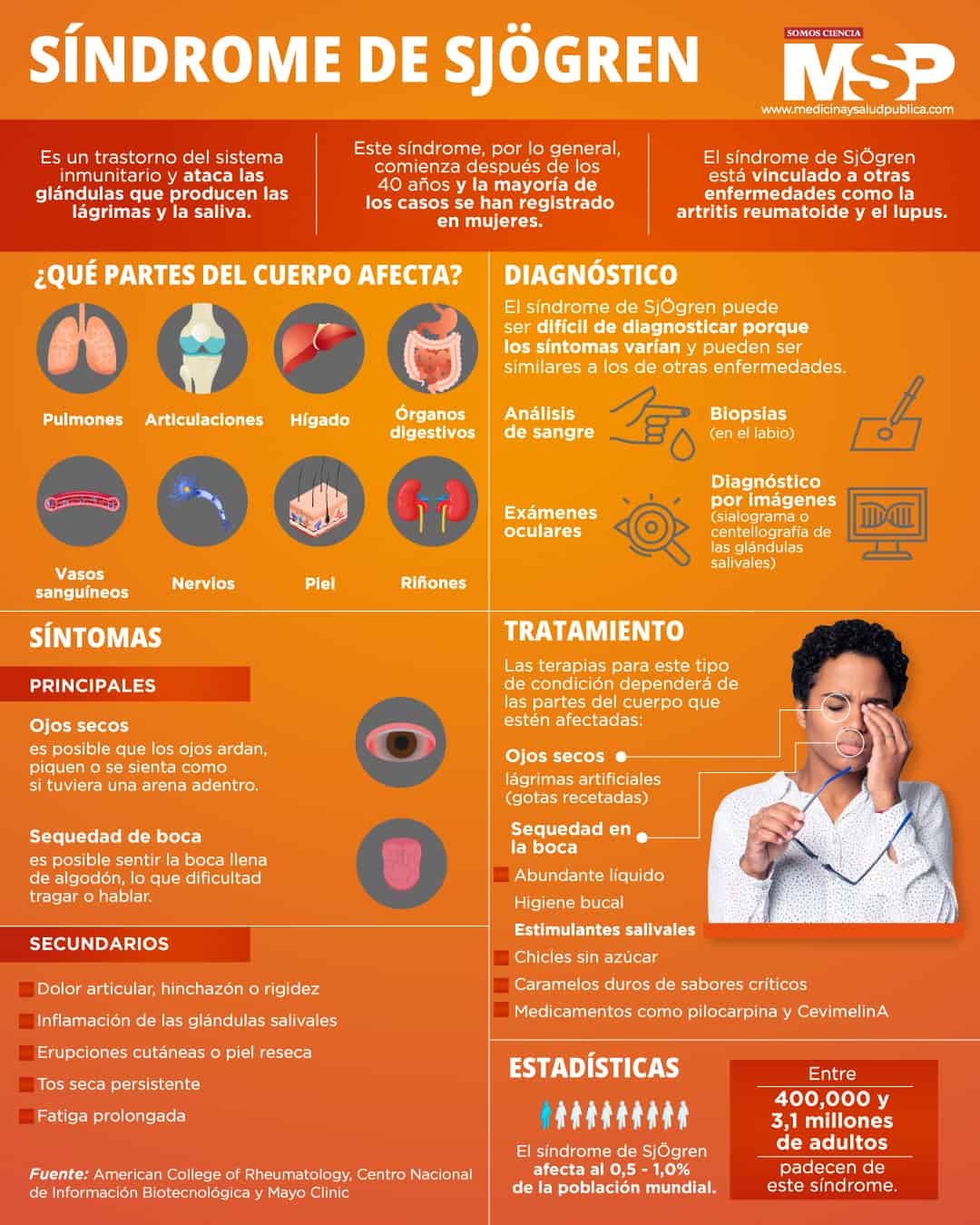 Como tratar a síndrome de Sjogren