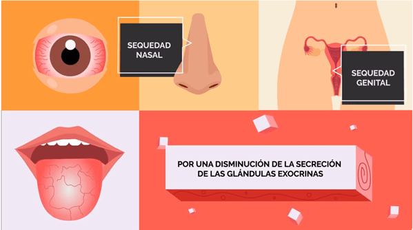 Como tratar a síndrome de Sjogren