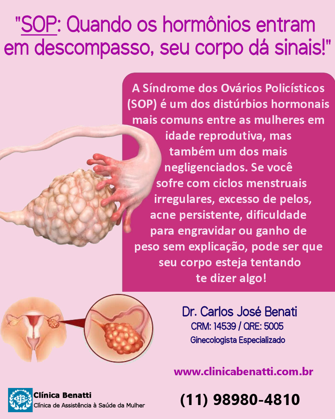 Dieta Ideal para SOP: Alimentos Permitidos e Proibidos; Exercícios Físicos que Ajudam no Controle da SOP; Como a Resistência à Insulina Afeta a SOP; Tratamentos Naturais para SOP: Mitos e Verdades; Fertilidade e SOP: Guia Completo para Engravidar; Riscos da SOP Não Tratada: Complicações a Longo Prazo