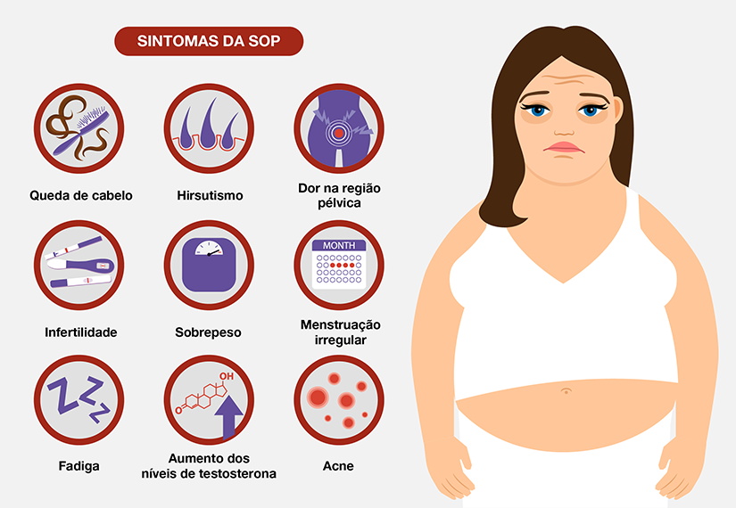 Como tratar a síndrome do ovário policístico