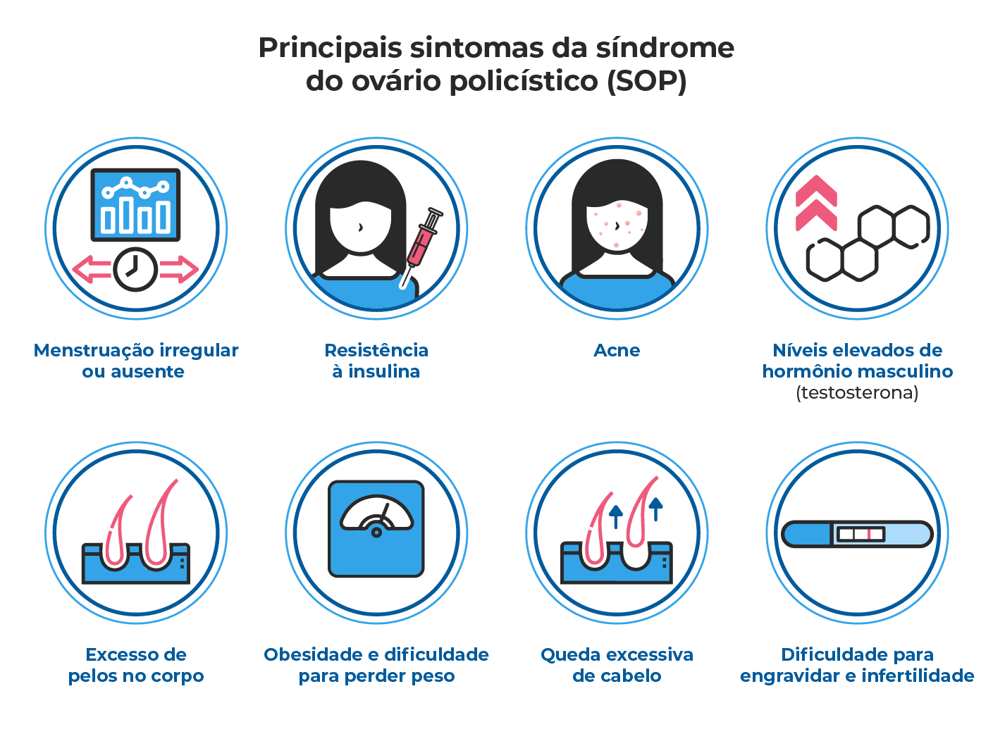 Como tratar a síndrome do ovário policístico