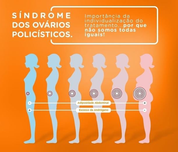 Dieta Ideal para SOP: Alimentos Permitidos e Proibidos; Exercícios Físicos que Ajudam no Controle da SOP; Como a Resistência à Insulina Afeta a SOP; Tratamentos Naturais para SOP: Mitos e Verdades; Fertilidade e SOP: Guia Completo para Engravidar; Riscos da SOP Não Tratada: Complicações a Longo Prazo