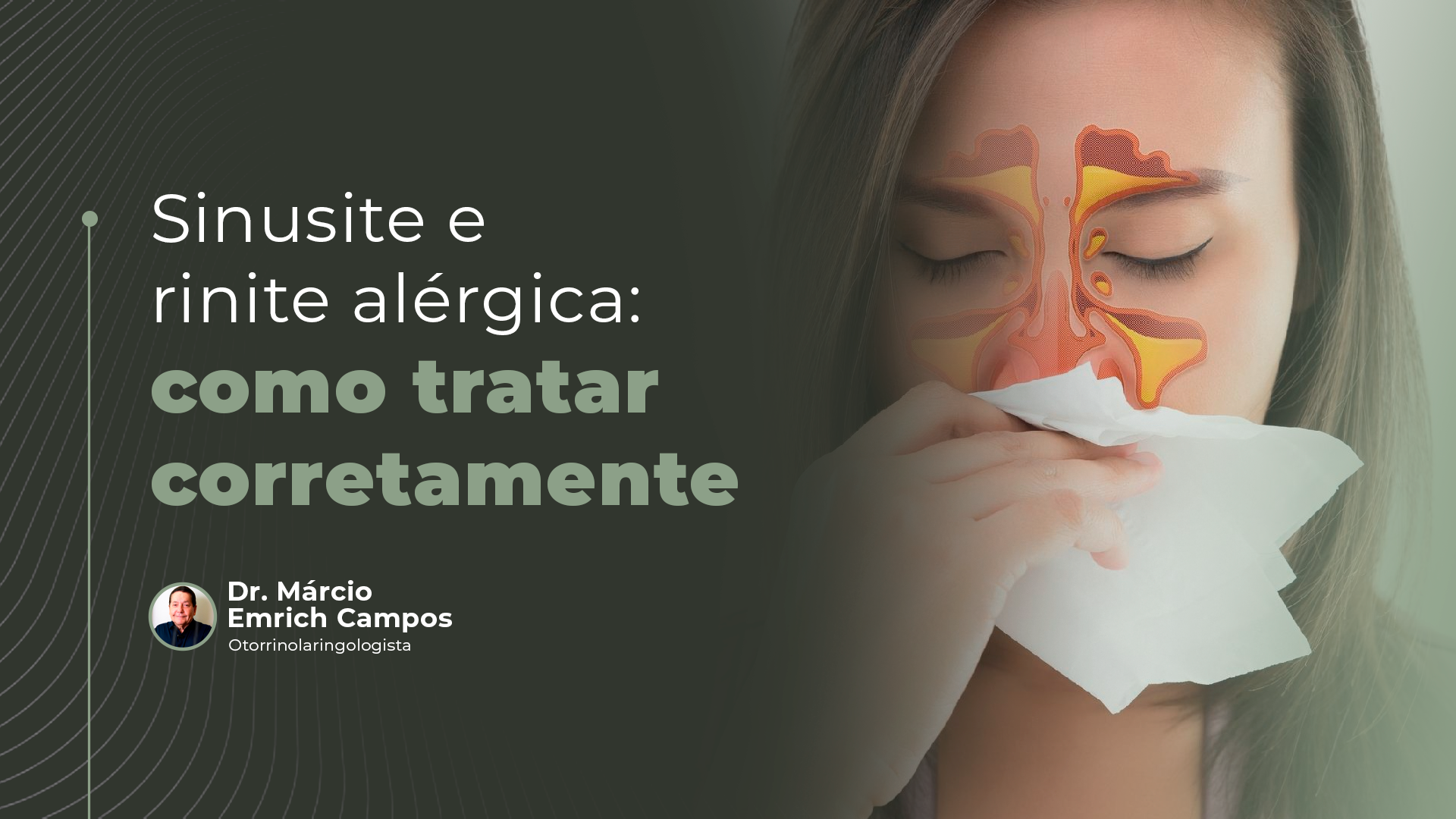 Guia completo de lavagem nasal para sinusite