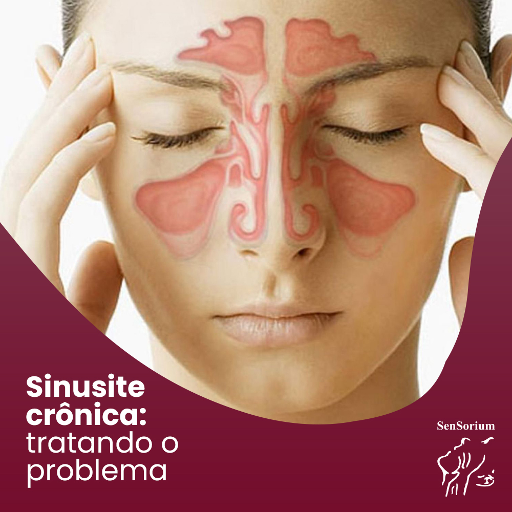 5 alimentos que pioram a sinusite alérgica