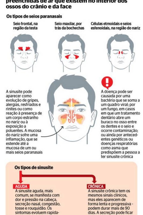 Imunoterapia: Uma Opção para Alergias Fúngicas Nasais?