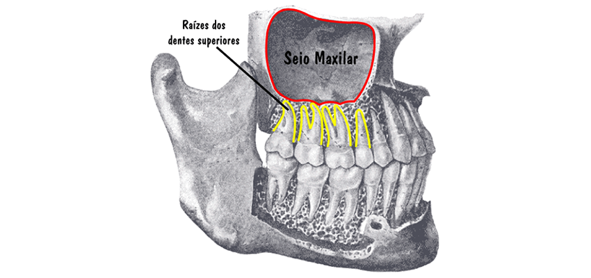 Dicas de controle ambiental para prevenir crises de sinusite