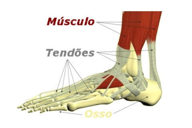 Quando Procurar um Fisioterapeuta para Tendinite