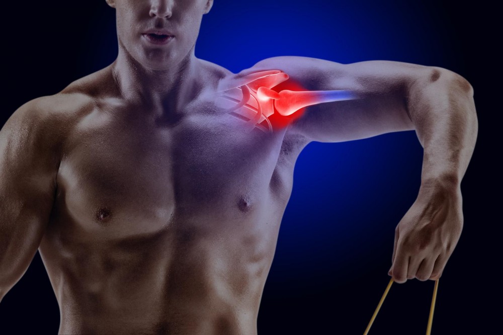 Prevenção de Tendinite: Dicas Essenciais para Evitar Lesões